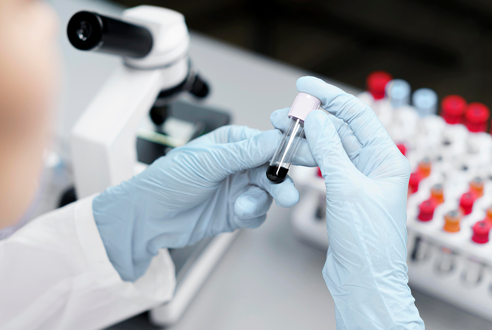Онкомаркеры: какие анализы помогают выявить рак на ранней стадии