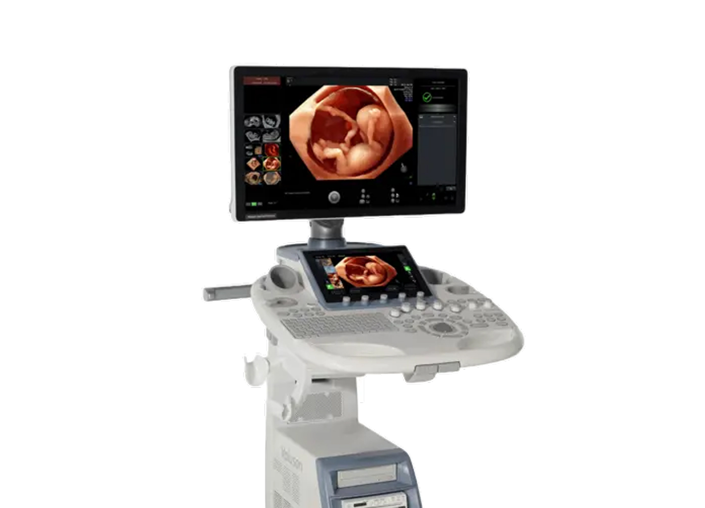 Voluson™ S8 Touch — УЗИ-диагностика экспертного класса для женского здоровья